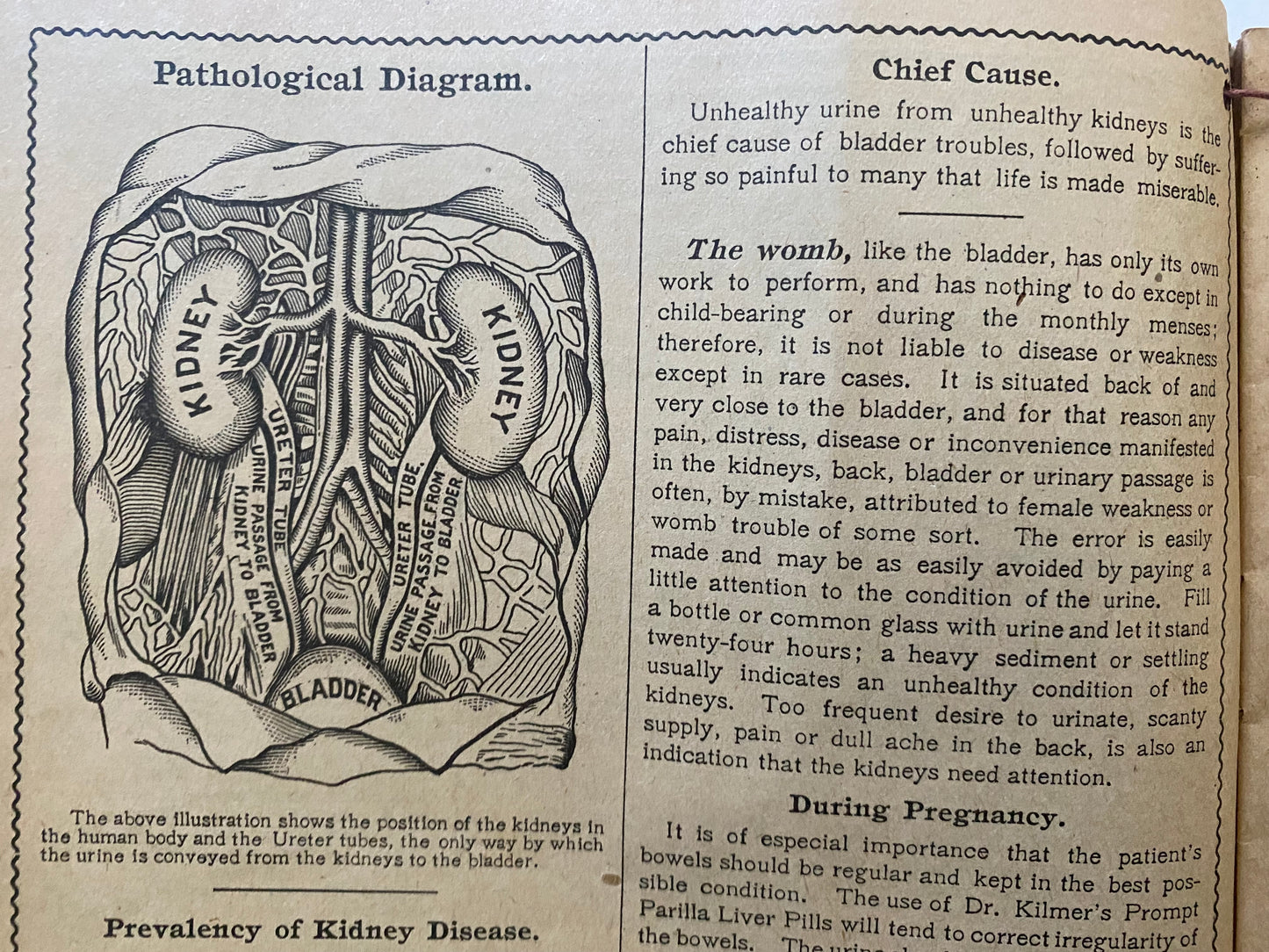 Rare 1917 Swamp Root Almanac